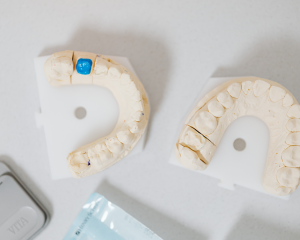 Dental Fillings